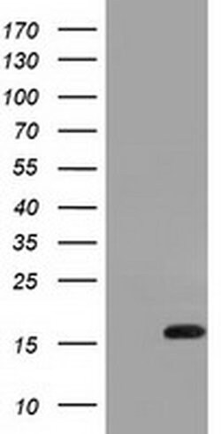 Invitrogen IL1F6 Monoclonal Antibody (OTI3A2) 100 &mu;L; Unconjugated:Antibodies,