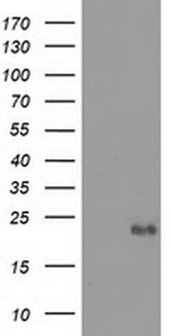 Invitrogen Ephrin A2 Monoclonal Antibody (OTI3E3) 100 &mu;L; Unconjugated:Antibodies,
