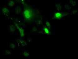 Invitrogen UCK1 Monoclonal Antibody (OTI4C2) 100 &mu;L; Unconjugated:Antibodies,