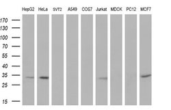 Invitrogen UCK1 Monoclonal Antibody (OTI4C2) 100 &mu;L; Unconjugated:Antibodies,