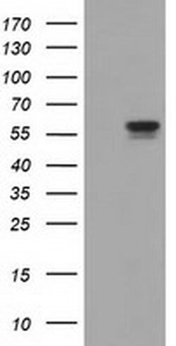 Invitrogen DYNC1LI1 Monoclonal Antibody (OTI1D1) 100 &mu;L; Unconjugated:Antibodies,