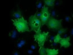 Invitrogen LIN7B Monoclonal Antibody (OTI1C9) 100 &mu;L; Unconjugated:Antibodies,