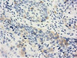Invitrogen LIN7B Monoclonal Antibody (OTI1C9) 100 &mu;L; Unconjugated:Antibodies,