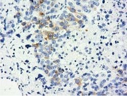 Invitrogen LIN7B Monoclonal Antibody (OTI1C9) 100 &mu;L; Unconjugated:Antibodies,