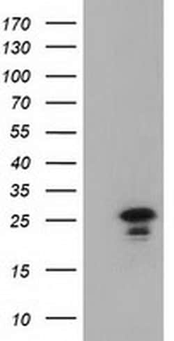 Invitrogen LIN7B Monoclonal Antibody (OTI1C9) 100 &mu;L; Unconjugated:Antibodies,