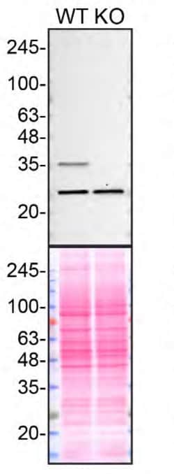 Invitrogen QPRT Monoclonal Antibody (OTI4E5) 100 &mu;L; Unconjugated:Antibodies,