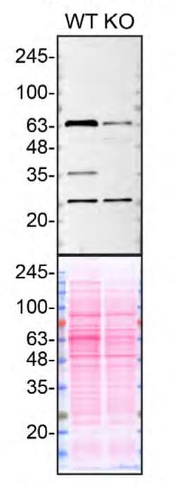 Invitrogen QPRT Monoclonal Antibody (OTI4E5) 100 &mu;L; Unconjugated:Antibodies,