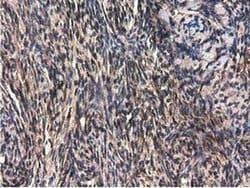 Invitrogen QPRT Monoclonal Antibody (OTI1C10) 100 &mu;L; Unconjugated:Antibodies,