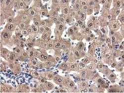 Invitrogen QPRT Monoclonal Antibody (OTI1C10) 100 &mu;L; Unconjugated:Antibodies,