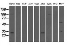 Invitrogen QPRT Monoclonal Antibody (OTI1C10) 100 &mu;L; Unconjugated:Antibodies,