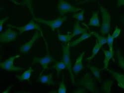 UCK1 Monoclonal Antibody (OTI1A12):Antibodies, Monoclonal