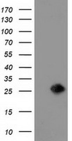 Invitrogen LIN7B Monoclonal Antibody (OTI1D12) 100 &mu;L; Unconjugated:Antibodies,