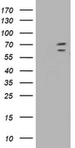 Invitrogen TRIM2 Monoclonal Antibody (OTI2B10) 100 &mu;L; Unconjugated:Antibodies,