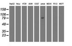 Invitrogen TRIM2 Monoclonal Antibody (OTI2B10) 100 &mu;L; Unconjugated:Antibodies,