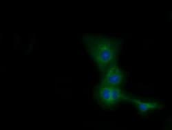 Invitrogen CBWD1 Monoclonal Antibody (OTI4D4) 100 &mu;L; Unconjugated:Antibodies,