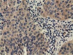 Invitrogen CBWD1 Monoclonal Antibody (OTI4D4) 100 &mu;L; Unconjugated:Antibodies,