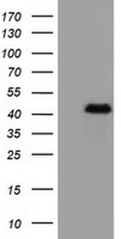 Invitrogen CBWD1 Monoclonal Antibody (OTI4D4) 100 &mu;L; Unconjugated:Antibodies,