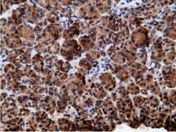 Invitrogen EPHX2 Monoclonal Antibody (OTI1H5) 100 &mu;L; Unconjugated:Antibodies,