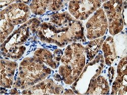 Invitrogen EPHX2 Monoclonal Antibody (OTI1H5) 100 &mu;L; Unconjugated:Antibodies,