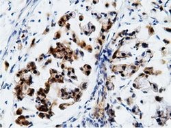 Invitrogen EPHX2 Monoclonal Antibody (OTI1H5) 100 &mu;L; Unconjugated:Antibodies,