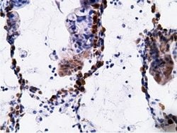 Invitrogen EPHX2 Monoclonal Antibody (OTI1H5) 100 &mu;L; Unconjugated:Antibodies,