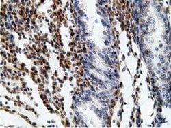 Invitrogen EPHX2 Monoclonal Antibody (OTI1H5) 100 &mu;L; Unconjugated:Antibodies,