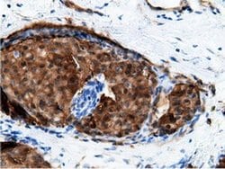 Invitrogen EPHX2 Monoclonal Antibody (OTI1H5) 100 &mu;L; Unconjugated:Antibodies,