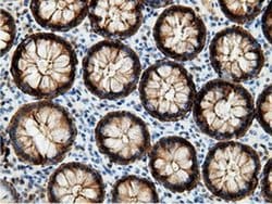 Invitrogen EPHX2 Monoclonal Antibody (OTI1H5) 100 &mu;L; Unconjugated:Antibodies,