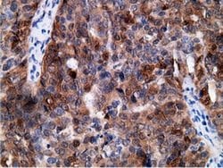 Invitrogen EPHX2 Monoclonal Antibody (OTI1H5) 100 &mu;L; Unconjugated:Antibodies,