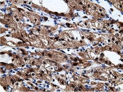 Invitrogen EPHX2 Monoclonal Antibody (OTI1H5) 100 &mu;L; Unconjugated:Antibodies,