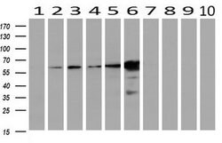 Invitrogen EPHX2 Monoclonal Antibody (OTI1H5) 100 &mu;L; Unconjugated:Antibodies,