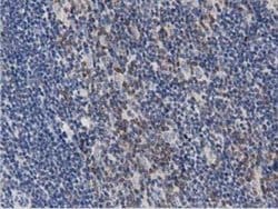 Invitrogen PRKD2 Monoclonal Antibody (OTI4F1) 100 &mu;L; Unconjugated:Antibodies,