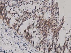 Invitrogen PRKD2 Monoclonal Antibody (OTI4F1) 100 &mu;L; Unconjugated:Antibodies,
