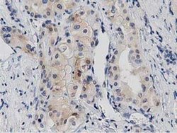 Invitrogen PRKD2 Monoclonal Antibody (OTI4F1) 100 &mu;L; Unconjugated:Antibodies,