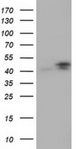 Invitrogen CBWD1 Monoclonal Antibody (OTI2D2) 100 &mu;L | Buy Online | Invitrogen&trade; | Fisher Scientific