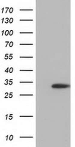 SULT2A1 Monoclonal Antibody (OTI1D2):Antibodies, Monoclonal