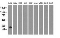 SULT2A1 Monoclonal Antibody (OTI1D2):Antibodies, Monoclonal