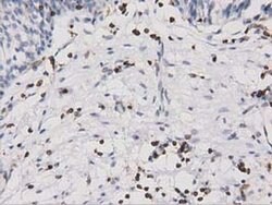Invitrogen ARHGAP25 Monoclonal Antibody (OTI2D5) 100 &mu;L; Unconjugated:Antibodies,