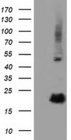 Invitrogen RBBP9 Monoclonal Antibody (OTI4G3) 100 &mu;L | Buy Online | Invitrogen&trade; | Fisher Scientific