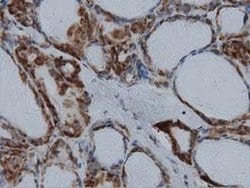 IVD Monoclonal Antibody (OTI1B10):Antibodies, Monoclonal
