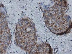 IVD Monoclonal Antibody (OTI1B10):Antibodies, Monoclonal