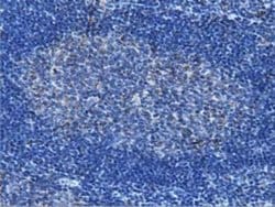 IVD Monoclonal Antibody (OTI1B10):Antibodies, Monoclonal