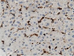 Invitrogen ARHGAP25 Monoclonal Antibody (OTI12G4) 100 &mu;L | Buy Online | Invitrogen&trade; | Fisher Scientific
