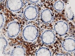 Invitrogen ARHGAP25 Monoclonal Antibody (OTI12G4) 100 &mu;L | Buy Online | Invitrogen&trade; | Fisher Scientific