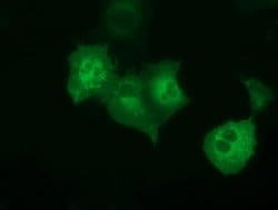 PECR Monoclonal Antibody (OTI2B2):Antibodies, Monoclonal