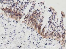 PECR Monoclonal Antibody (OTI2B2):Antibodies, Monoclonal