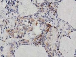 PECR Monoclonal Antibody (OTI2B2):Antibodies, Monoclonal