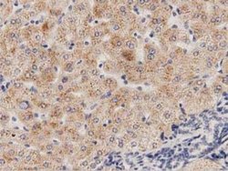 PECR Monoclonal Antibody (OTI2B2):Antibodies, Monoclonal