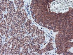 PECR Monoclonal Antibody (OTI1F2):Antibodies, Monoclonal