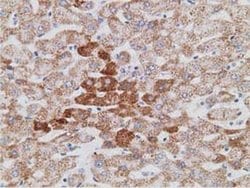 Invitrogen PECR Monoclonal Antibody (OTI1C9) 100 &mu;L; Unconjugated:Antibodies,